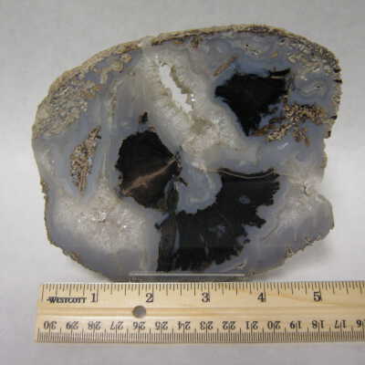 Limb Cast