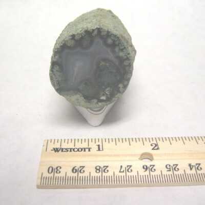 Limb Cast