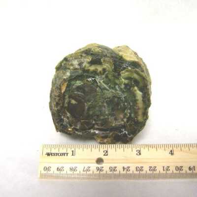 Limb Cast