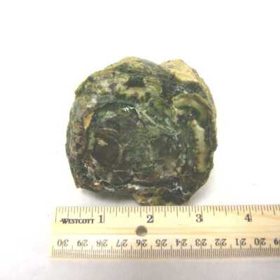 Limb Cast