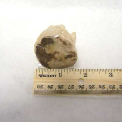 Limb Cast
