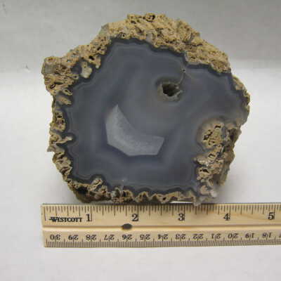 Limb Cast