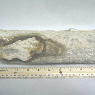 Limb Cast