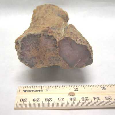 Limb Cast