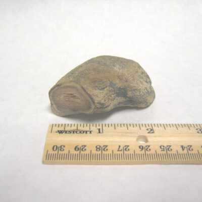 Limb Cast