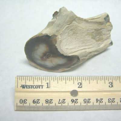 Limb Cast