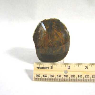 Limb Cast