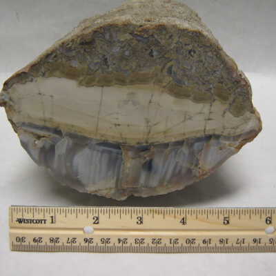 Limb Cast