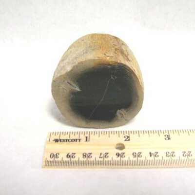 Limb Cast