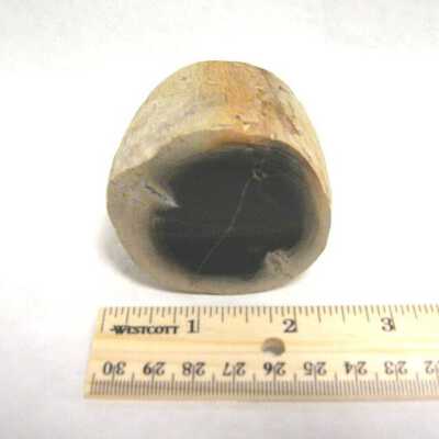 Limb Cast