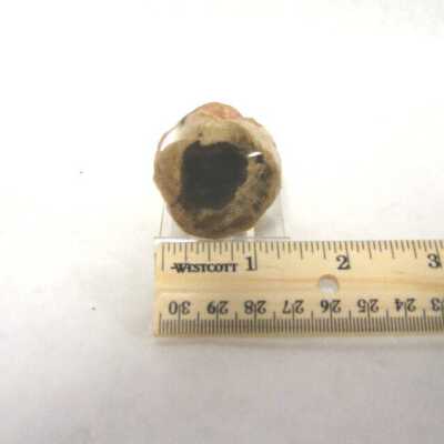 Limb Cast