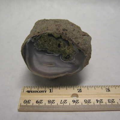 Limb Cast