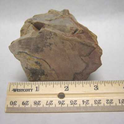 Limb Cast