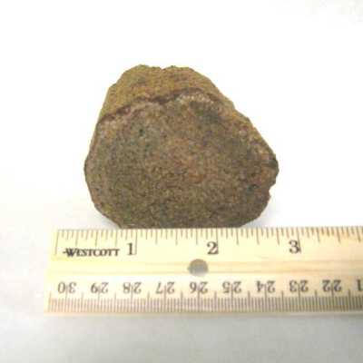 Limb Cast