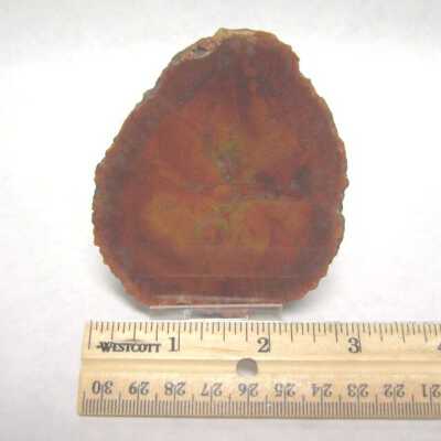 Limb Cast