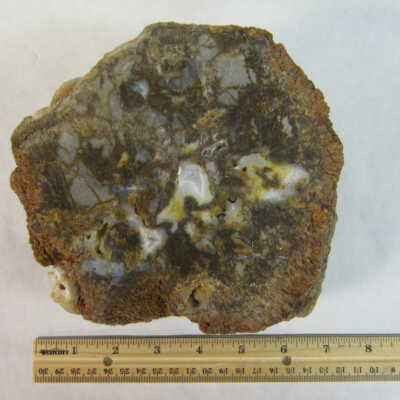 Limb Cast
