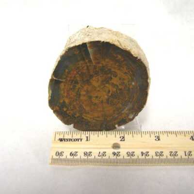 Limb Cast