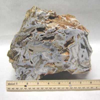 Limb Cast