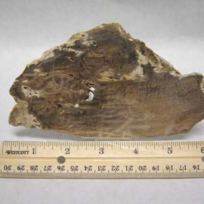 Limb Cast
