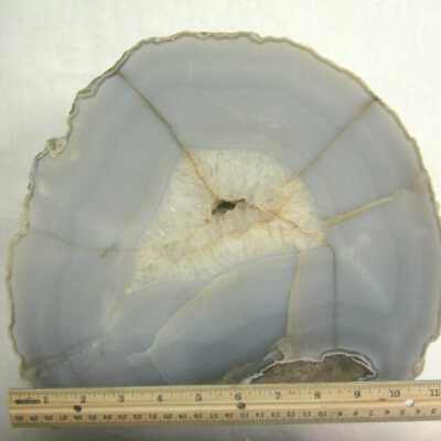 Limb Cast
