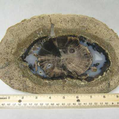Limb Cast