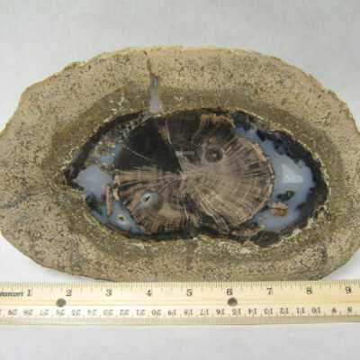 Limb Cast