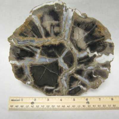 Limb Cast