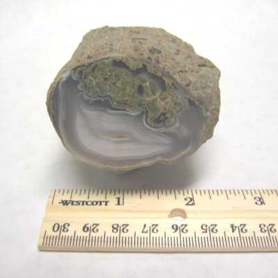 Limb Cast