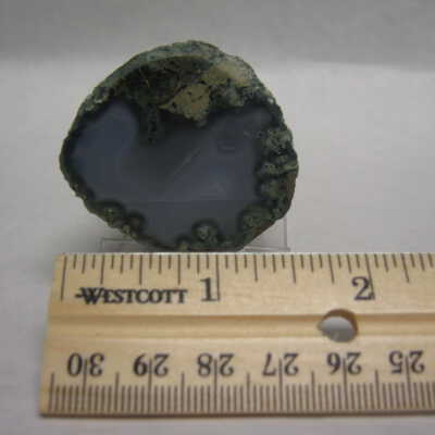 Limb Cast