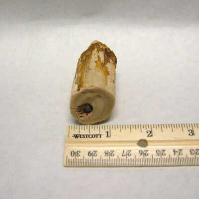 Limb Cast