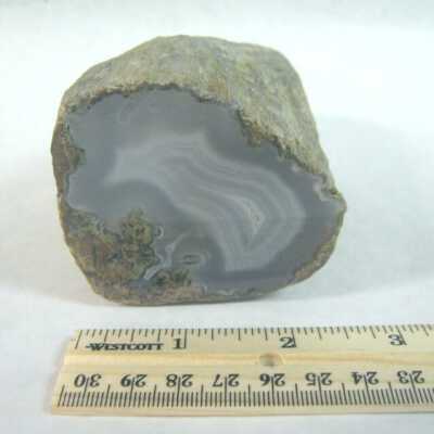 Limb Cast