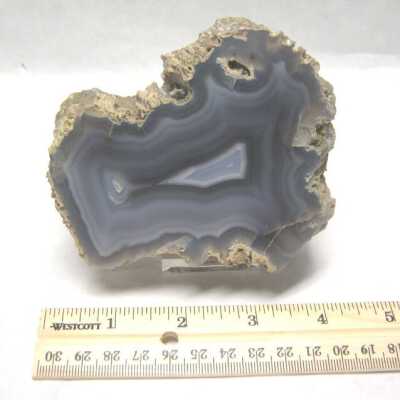 Limb Cast