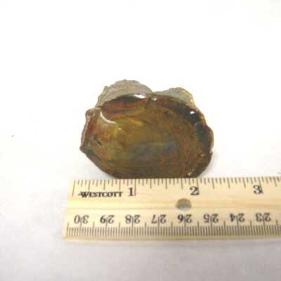Limb Cast