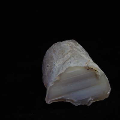 Limb cast