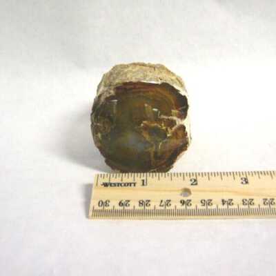 Limb Cast