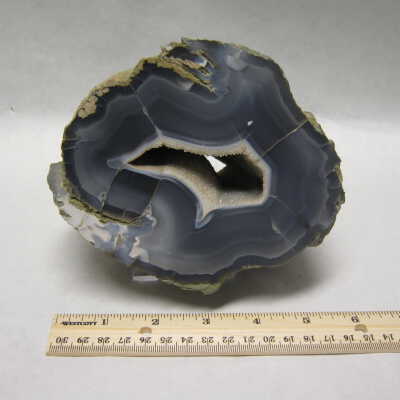 Limb Cast
