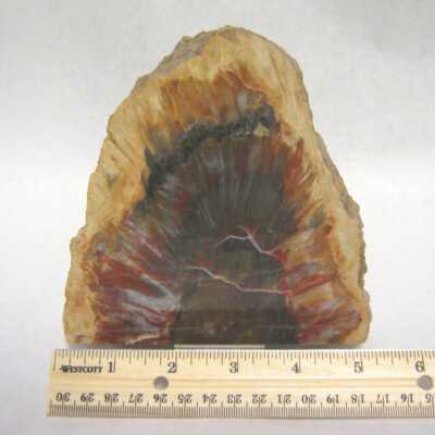 Limb Cast