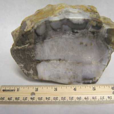 Limb Cast