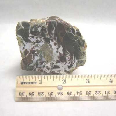 Limb Cast