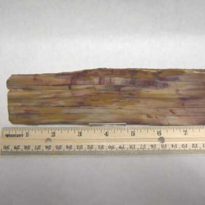 Limb Cast