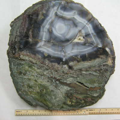 Limb Cast