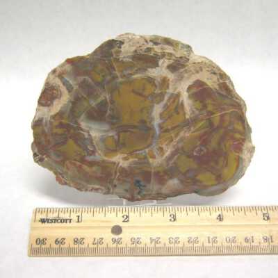 Limb Cast