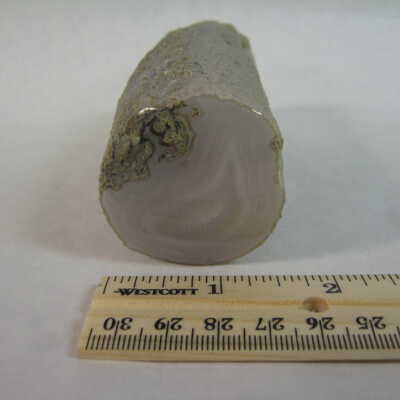 Limb Cast