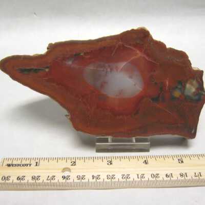 Limb Cast
