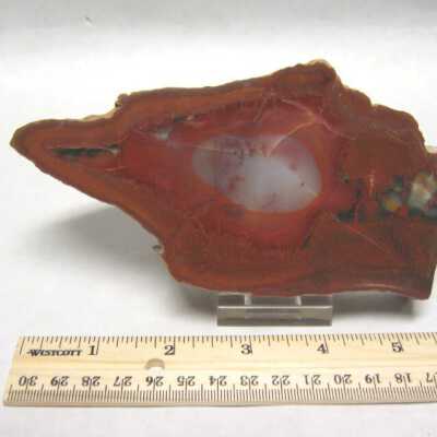 Limb Cast