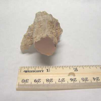 Limb Cast
