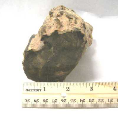 Limb Cast