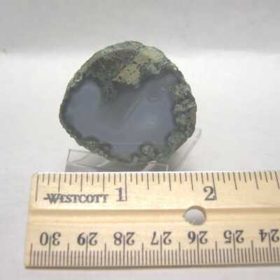 Limb Cast