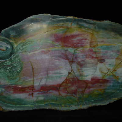Limb Cast
