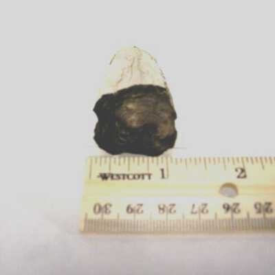 Limb Cast